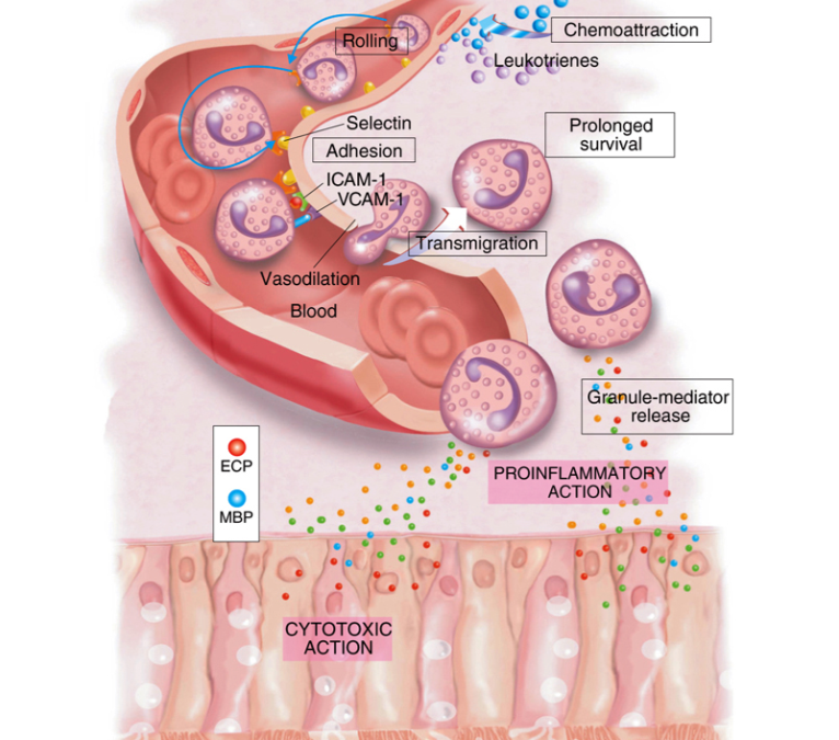 Eosinofil & Alergi: Sel Inflamasi Utama Reaksi Alergi Kronik